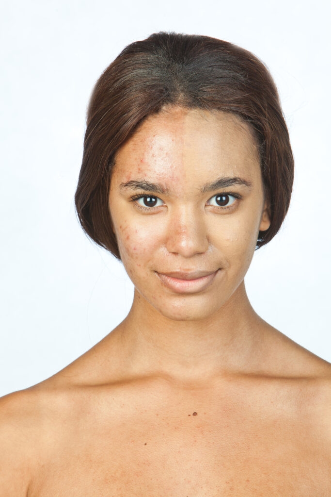 Oxygenetix Foundation makeup with skincare
