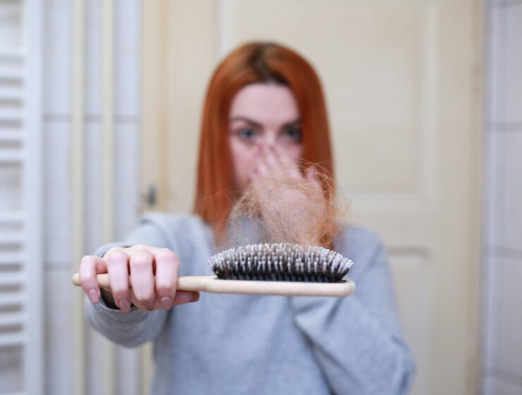 hair loss pixabay image